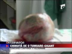 Chinuita de o tumoare-gigant