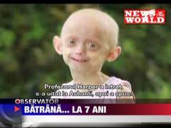 Caz medical straniu in Marea Britanie