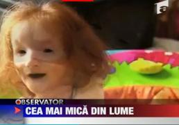 Ea este cea mai mica persoana din lume