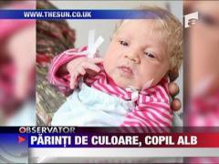 Un cuplu de culoare a adus pe lume un copil alb