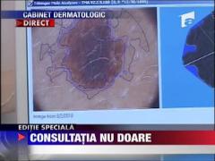 Consultatia nu doare! Cancerul de piele omoara! Soarele ucide!