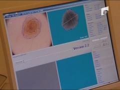 Diagnostic: Cancer de piele! Soarele ucide!