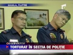 IMAGINI SOCANTE/ Torturat in sectia de politie