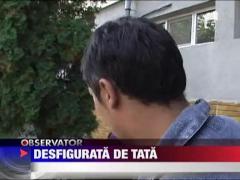 Desfigurata de tata! Batuta cu bestialitate!