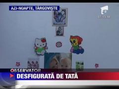 Desfigurata de tata
