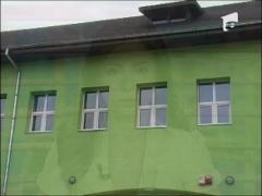 Desfigurat in fata scolii! Mandibula dublu-fracturata!