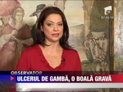 Felicia: Ulcerul de gamba, o boala grava
