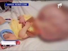 IMAGINI SOCANTE! Bebelus nascut cu un cap gigantic