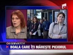 Acromegalia, evolutia bolii