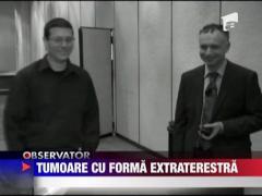 Tumoare cu forma extraterestra