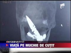 Un barbat din China a trait 4 ani cu o lama de cutit in craniu