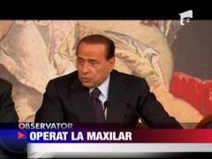 Silvio Berlusconi a fost operat ca sa poata mesteca normal