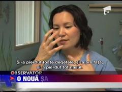 O noua sansa la viata, dupa un incendiu care l-a mutilat