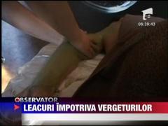 Felicia / Leacuri impotriva vergeturilor