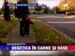 Degetica in carne si oase