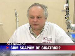 Cum scapam de cicatrici