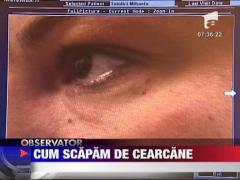 Cum scapam de cearcane