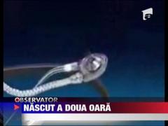 Primul roman cu inima artificiala