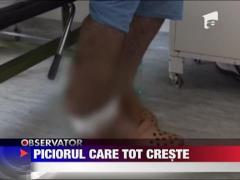 Picior de om ca de elefant!