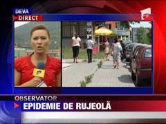 Epidemie de rujeola in Alba