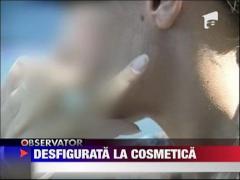 Tanara desfigurata la cosmetica