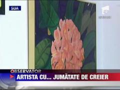 A pierdut jumatate de creier si a devenit artista