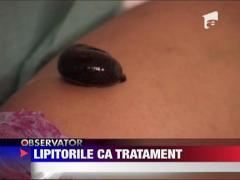 Terapii miraculoase cu lipitori