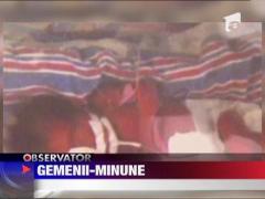 O tanara aflata in moarte cerebrala a adus pe lume gemeni