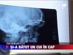 Un detinut si-a batut un cui in cap