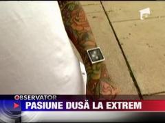 Si-a implantat patru tije metalice in incheietura mainii pentru un iPod