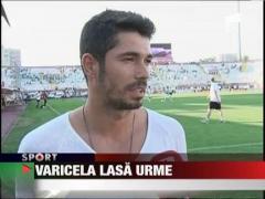 Ovidiu Herea a ramas cu semne, dupa ce s-a vindecat de varicela