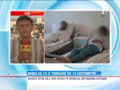 Iasi: O femeie a adus pe lume un bebelus cu o tumora de 14 centimetri