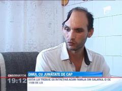 Socant! Un barbat din Pitesti traieste cu jumatate de craniu