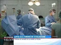 Medicii clujeni incearca sa indeparteze o tumora de 18 kilograme