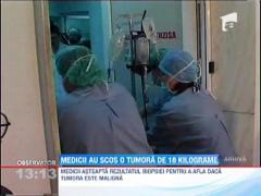 Observator 13 Weekend