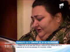 Traieste cu o tumora de 50 de kilograme pe piciorul stang