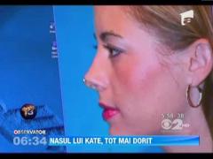 Tot mai multe femei isi modeleaza nasul dupa cel al ducesei de Cambridge