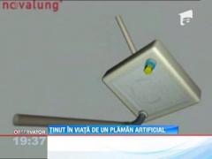 Medicii de la Spitalul Judetean din Timisoara i-au montat unui tanar un plaman artificial