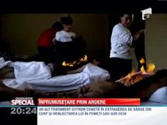 Observator Special: Tratamentul facial prin foc, ultima gaselnita pentru doamnele care viseaza la un ten de adolescenta