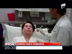 Procedura de intinerire dureroasa, dar eficienta! Medicii pot indeparta zece ani de pe figura pacientului
