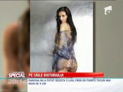 Observator Special: Lista vedetelor care si-au facut operatii estetice de mii de euro