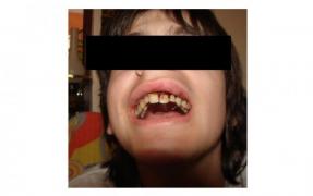 Un baiat din Buzau, batut crunt de o gasca rivala