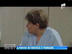 Crezand ca este insacinata, a purtat in pantece o tumora de cinci kilograme