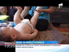 Boala copilului fluture: Un baietel din Botosani risca sa moara daca il atinge cineva