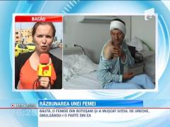 Botosani: Bauta, o femeie si-a muscat sotul de ureche pana a smuls-o