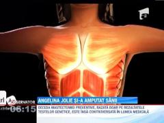 Angelina Jolie si-a facut dubla mastectomie