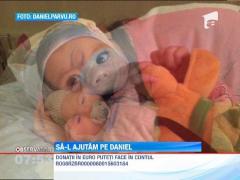 Micutul Daniel are nevoie de 100.000 de lire pentru o operatie