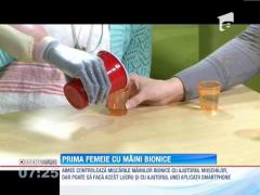Prima femeie cu maini bionice