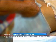 Socant! Un barbat a ajuns sa fie mancat de viu de viermi