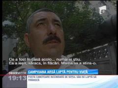 Campioana incendiata de sot lupta pentru viata